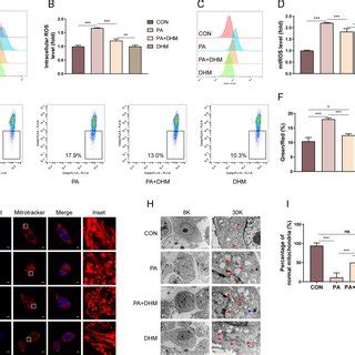 DHM Inhibits PA Induced Oxidative Stress In Hepatocytes HepG2 Cells