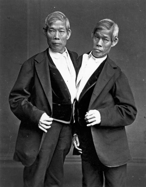 The Fruitful Sex Lives Of The Original Siamese Twins