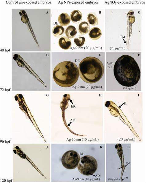 Representative Images Of The Normally Developed Unexposed Zebrafish