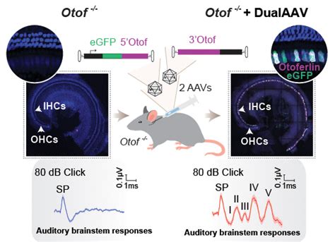 A Dualaav Approach Restores Fast Exocytosis And Partially Rescues