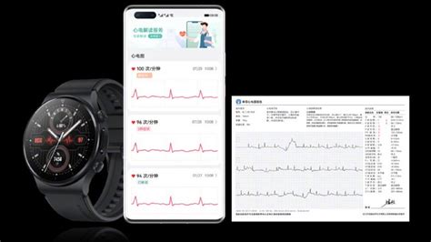 Huawei Watch Gt Pro Ekg Ve Band Pro Duyuruldu Webtekno