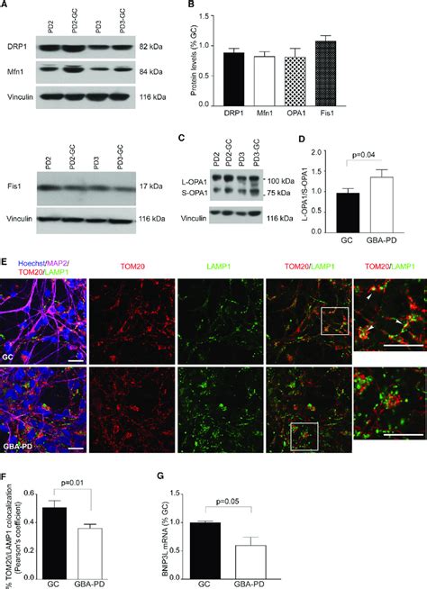 Mitochondrial Dynamics In Gba Pd Ipsc Neurons A And B Western Blot Of