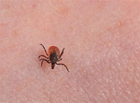 Lyme Disease Lyme Borreliosis