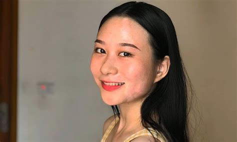 CiiN bị bệnh hiếm chỉ 1 dân số thế giới mắc Ngô Đình Nam xót cho bạn gái Hot KOLs Đời