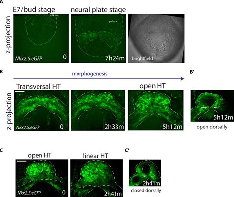 Figures And Data In Live Imaging Of Heart Tube Development In Mouse