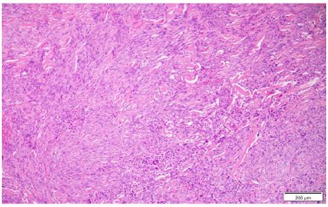 Figure 4 Hematoxylin And Eosin Staining X100 Magnification Cellular