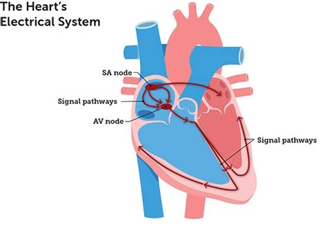 Cardiac Arrhythmias Irregular Heartbeat Causes Types And Treatment