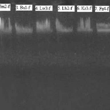 Genomic DNA Concentration Determined By Electrophoretic Ethidium