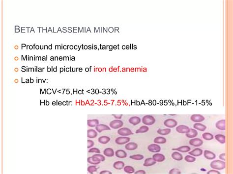 Approach To Hemolytic Anemia Ppt