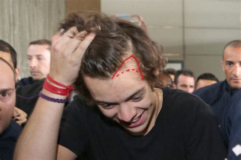 Harry Styles’ Hair Loss: How Bad Is It? – nicehair.org