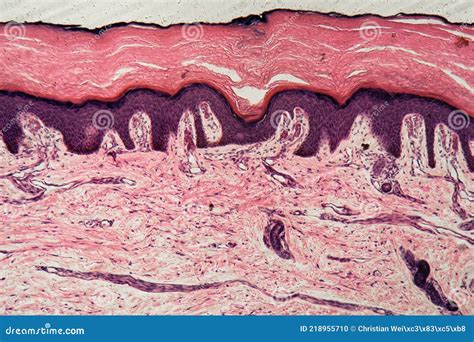 Human Skin With Sweat Glands Stock Photo Image Of Health Biology