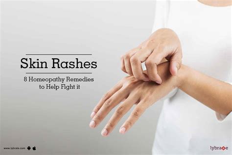 Skin Rashes 8 Homeopathy Remedies To Help Fight It By Dr Anita