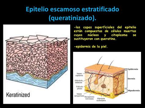 Epitelio Escamoso Estratificado