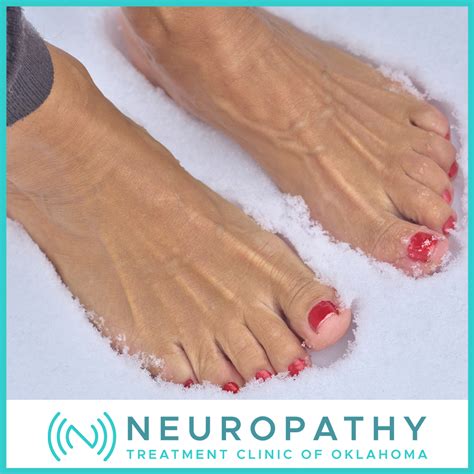 Got Cold Feet? You May Have Peripheral Neuropathy