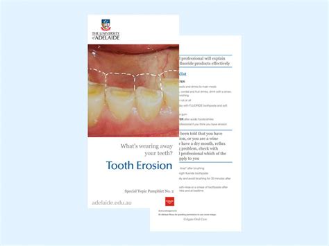 Dental Erosion Dental Practice Education Research Unit University Of Adelaide