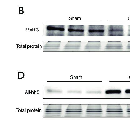 Expression Levels Of M A Rna Methylation Related Regulators A