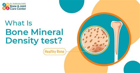 What Is Bone Mineral Density Test? Tips By Orthopedic Doctor