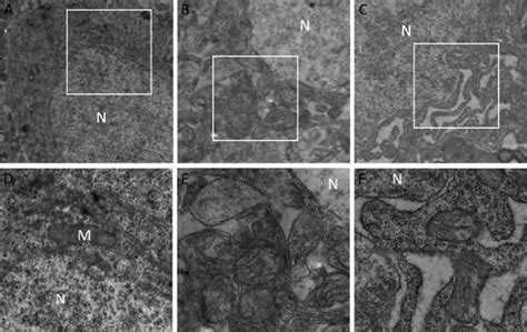 Transmission electron microscopic images of hippocampus control (A, D ... 