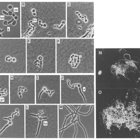 A O Regeneration Of Beauveria Bassiana Gk2016 Protoplasts A Download Scientific Diagram