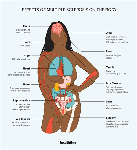 The Effects Of Multiple Sclerosis On Your Body