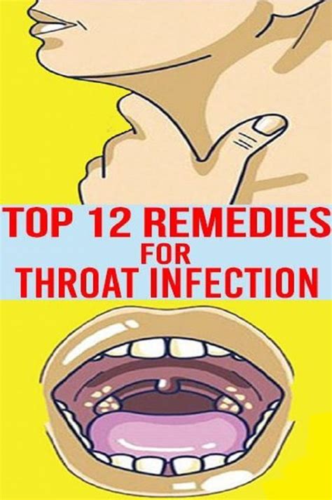 Antibiotic For Sore Throat Philippines