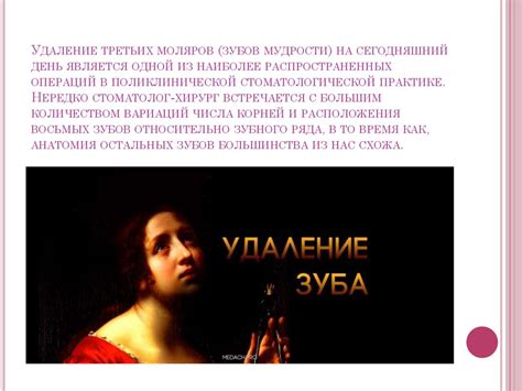 Удаление третьих моляров верхней и нижней челюсти. Ретенция и дистопия ...