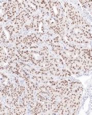 Anti TRPS1 Antibody SQab30333 ARG67048 Arigo Biolaboratories