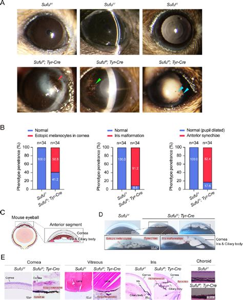 Conditional Knockout CKO Of Sufu In The Melanocyte Lineage Leads To