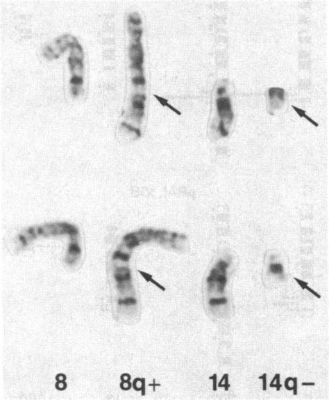 Partial Karyotype Of A Trypsin Giemsa Banded Metaphase Cell Of The