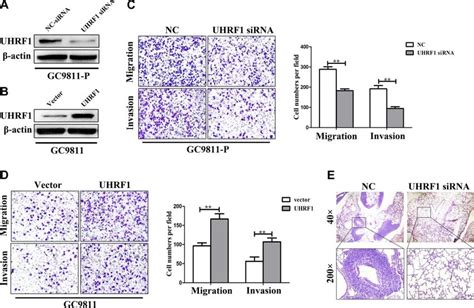 Down Regulation Of Uhrf Inhibited Gc Cell Invasion And Metastasis A