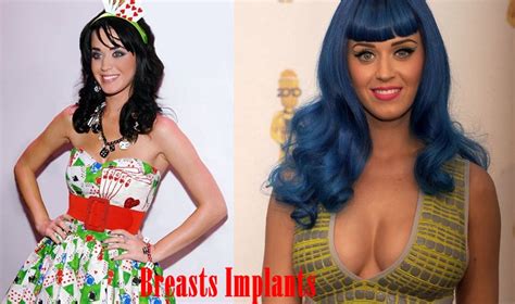 Katy Perry Breast Implants Before And After