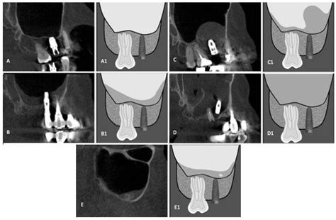 Diagnostics Free Full Text Evaluation Of The Maxillary Sinus Of