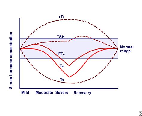 Euthyroid Sick Syndrome