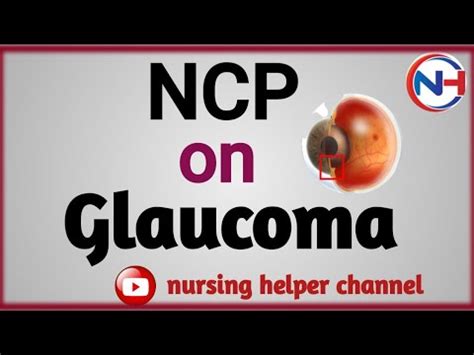 Ncp On Glaucoma Nursing Care Plan On Glaucoma Glaucoma YouTube