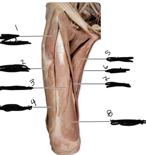 Anterior Thigh Muscles Cadaver Flashcards Quizlet