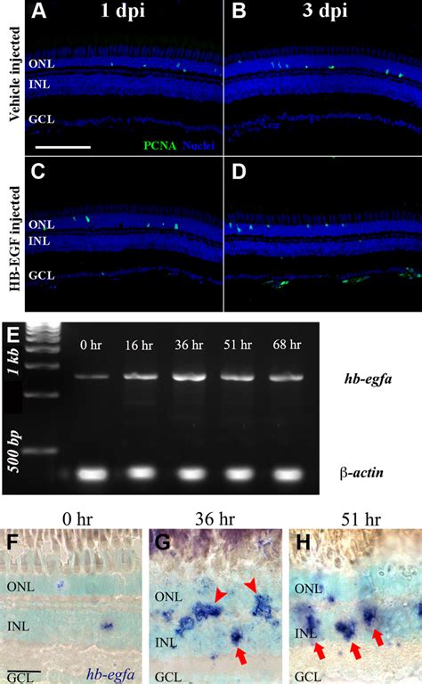 Hb Egf Which Increases In Expression In The Müller Glia Of The