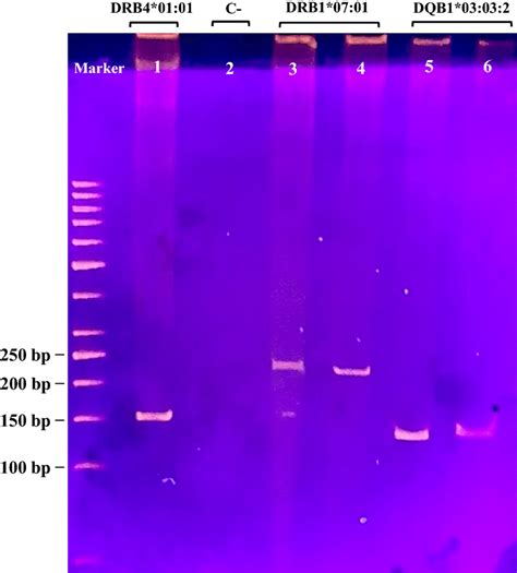 Illustration Of Pcr Ssp Technique For Hla Typing Using Polyacrylamide