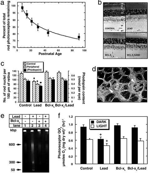 Bcl Xl Overexpression Blocks Bax Mediated Mitochondrial Contact Site