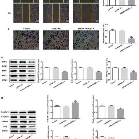 Knockdown Of Rhbdd Suppresses Cell Migration Invasion And Emt In