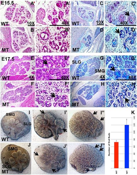 Hematoxylin And Eosin Alcian Blue And Periodic Acidschiff Staining