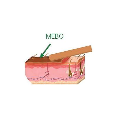 Buy Mebo Burn Fast Relief Pain Cream Skin Healing Ointment Wound Scar