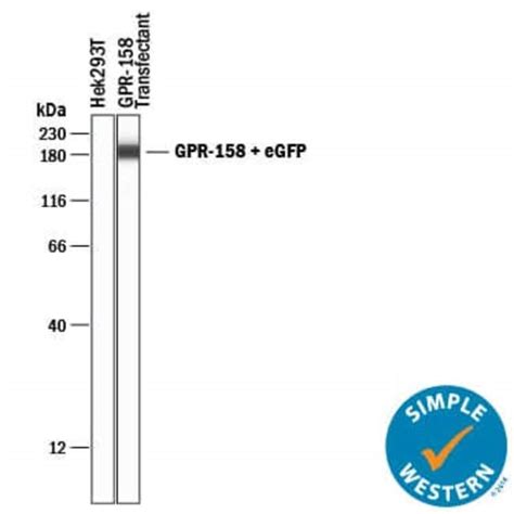 Human GPR158 Antibody R D Systems 25 μg Unconjugated Fisher Scientific