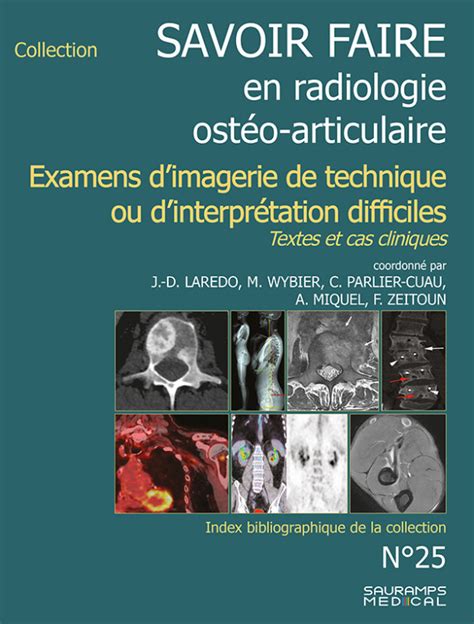 Savoir Faire En Radiologie Ost O Articulaire N Jean Denis Laredo