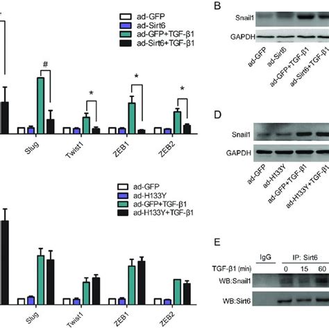 Sirt6 Inhibits The Expression Of EMT Related Transcription Factors