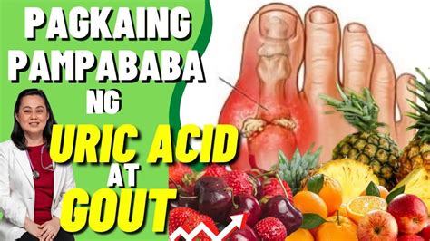 Pagkaing Pampababa Ng Uric Acid At Gout By Doc Liza Ramoso Ong