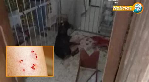 Terror Rottweiler Ataca A Tres Personas Una De Ellas Con Graves