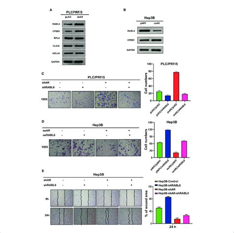 Armir 122 5p Axis May Influence Hcc Cells Invasion And Migration