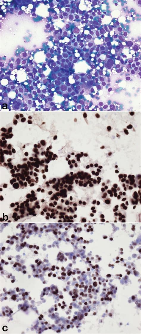 The Usefulness Of The Cell Transfer Technique For Immunocytochemistry