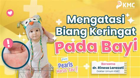 CARA MENGATASI BIANG KERINGAT PADA BAYI YouTube