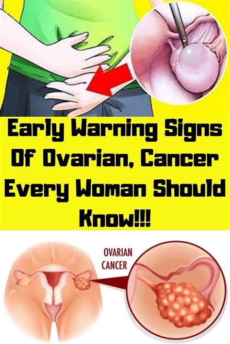 Early Warning Signs Of Ovarian Cancer Every Woman Should Know Yoga4daily